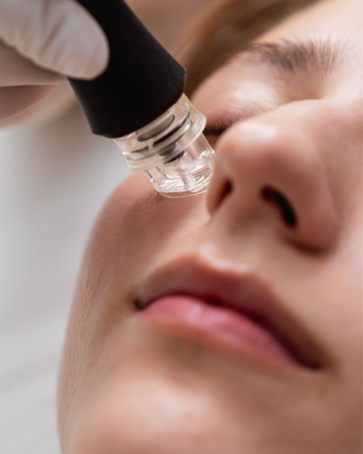 Hidrofacial
