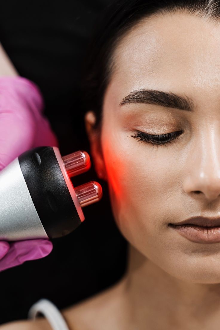 Radiofrecuencia facial