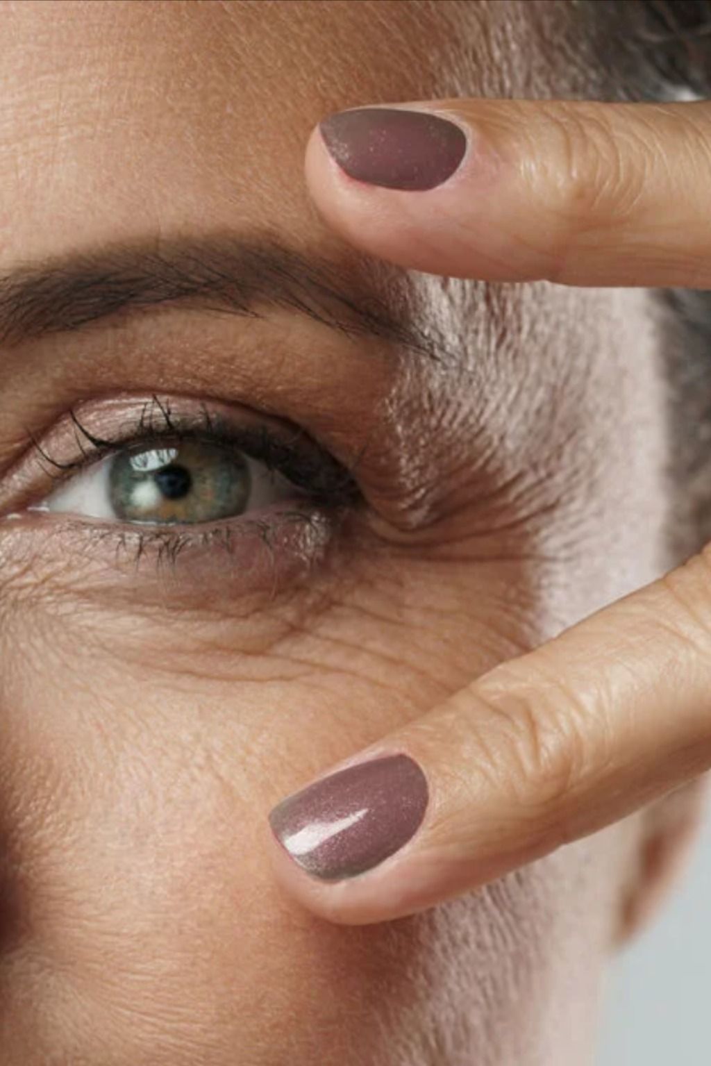 Tratamiento para ojeras