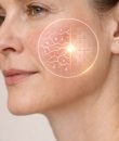 5.Bioestimulación de colágeno