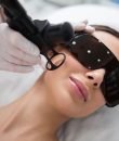 Láser CO2 facial