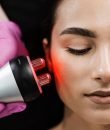 Radiofrecuencia facial